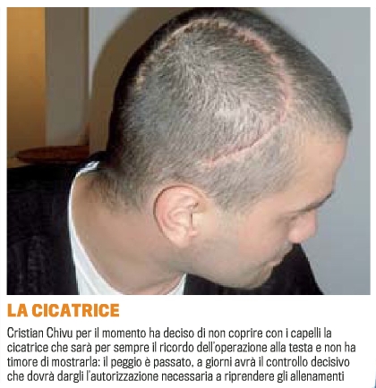 Cicatricea de pe scalpul lui Cristi Chivu