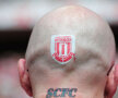 Suporterul lui Stoke şi-a tatuat stema clubului pe ceafă şi iniţialele clubului favorit pe gît