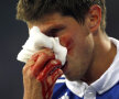Accidentări grave suferite de Huntelaar (Schalke) şi de Schweinsteiger  (Bayern) Foto: Reuters