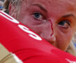 Feline periculoase. Luptătoarea suedeză Sofia Mattsson s-a ales cu nasul zgîriat în meciul cu rusoaica Valeriia Jolobova