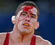Traseul de sînge. Rîurile roşii s-au unit pe faţa luptătorului venezuelean Ricardo Moreno // Foto: Reuters