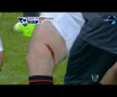 FOTO (captură): Wayne Rooney va absenta cel puţin o lună după această accidentare