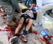 FOTO & VIDEO ATENŢIE! Galerie foto terifiantă: 3 victime şi peste 140 de răniţi în Boston » Băieţelul de 8 ani ucis de explozie a fost identificat