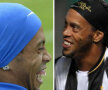 FOTO » Înainte şi după Ronaldinho nu mai e dinţos! Cum arată după intervenţia chirurgicală