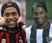 FOTO » Înainte şi după Ronaldinho nu mai e dinţos! Cum arată după intervenţia chirurgicală