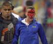 Imaginea fanului însîngerat a
fost preluată de site-uri
sportive din întreaga lume: au
fost atacați și copii sau femei Foto: Ștefan Constantin