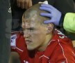 RAMBO. Slovacul Skrtel (Liverpool) a avut nevoie de 7 minute de îngrijri și de 7 copci după ce Giroud (Arsenal) i-a spart capul