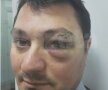 FOTO Fulgerător » Un arbitru a fost lovit de un internaţional român la un turneu amical!