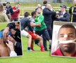 GALERIE FOTO Meciul groazei  în Germania: un fotbalist riscă să-și piardă un ochi după ce a fost snopit în bătaie. Atenție, imagini dure!