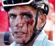 Imagini horror din Turul Spaniei » Abandon + 40 de puncte de sutură