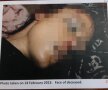 FOTO Atenție, imagini care vă pot afecta emoțional! Fotografii îngrozitoare cu iubita lui Pistorius după ce a fost ucisă » Familia ei a cerut să fie publicate