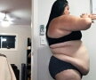 O femeie de 28 de ani avea 170 de kilograme. Ce a urmat a uimit întreaga lume