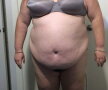O femeie de 28 de ani avea 170 de kilograme. Ce a urmat a uimit întreaga lume