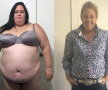 O femeie de 28 de ani avea 170 de kilograme. Ce a urmat a uimit întreaga lume