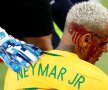 SPORT SÂNGEROS. Neymar a ieșit foarte șifonat după meciul Brazilia - Bolivia, 5-0. Lovit cu cotul de Yasmani Duk, superstarul Barcelonei arăta mai degrabă ca după o luptă în ring cu Van Damme (foto: Reuters)
