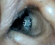 VIDEO & FOTO O femeie a adormit pe terasă, însă la scurt timp a ajuns de urgenţă la spital. E incredibil ce i s-a întâmplat!
