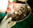 FOTO Medicii au fost şocaţi când au văzut ce are în stomac un bărbat din India!