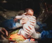GALERIE FOTO O femeie și-a scos singură copilul din pântece, în timpul operației de cezariană