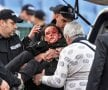 SCENE ȘOCANTE! O polițistă plină de sânge la ȚSKA - LEVSKI: "Avea multe bucăți de sticlă pe față și în ochi"