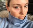FOTO Și-au arătat vânătăile! Imagine inedită postată de Lindsey Vonn după ce a căzut de pe schiuri