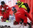 FOTO Și-au arătat vânătăile! Imagine inedită postată de Lindsey Vonn după ce a căzut de pe schiuri