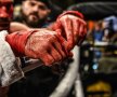 Mâinile lui Artem Lobov, după o luptă fără mănuși, foto: Forbes