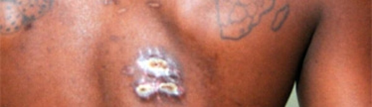 FOTO / gsp.ro îţi oferă imagini cu urmele de gloanţe pe Serge Akakpo!