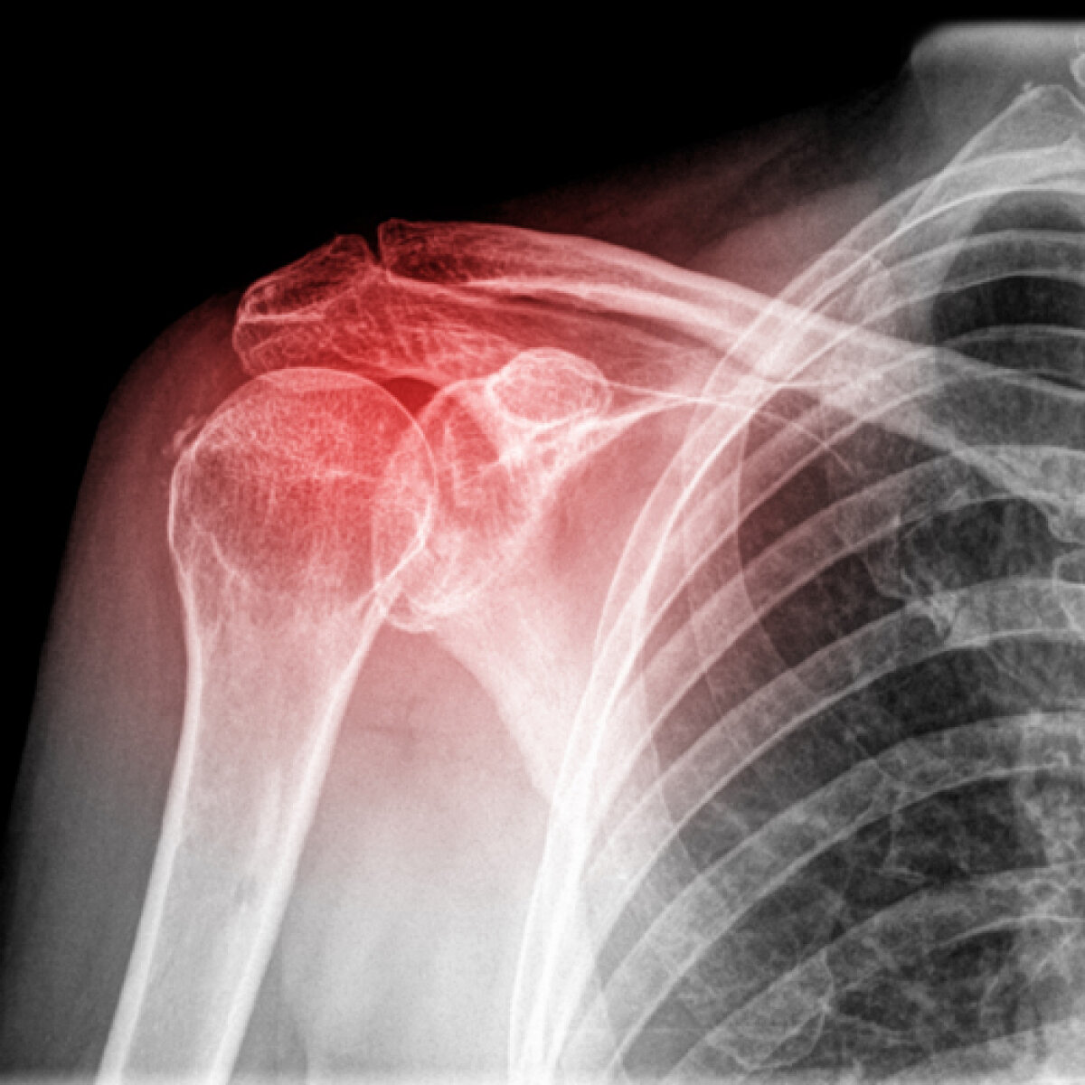 Gaţu, alertat de starea Cristinei Neagu