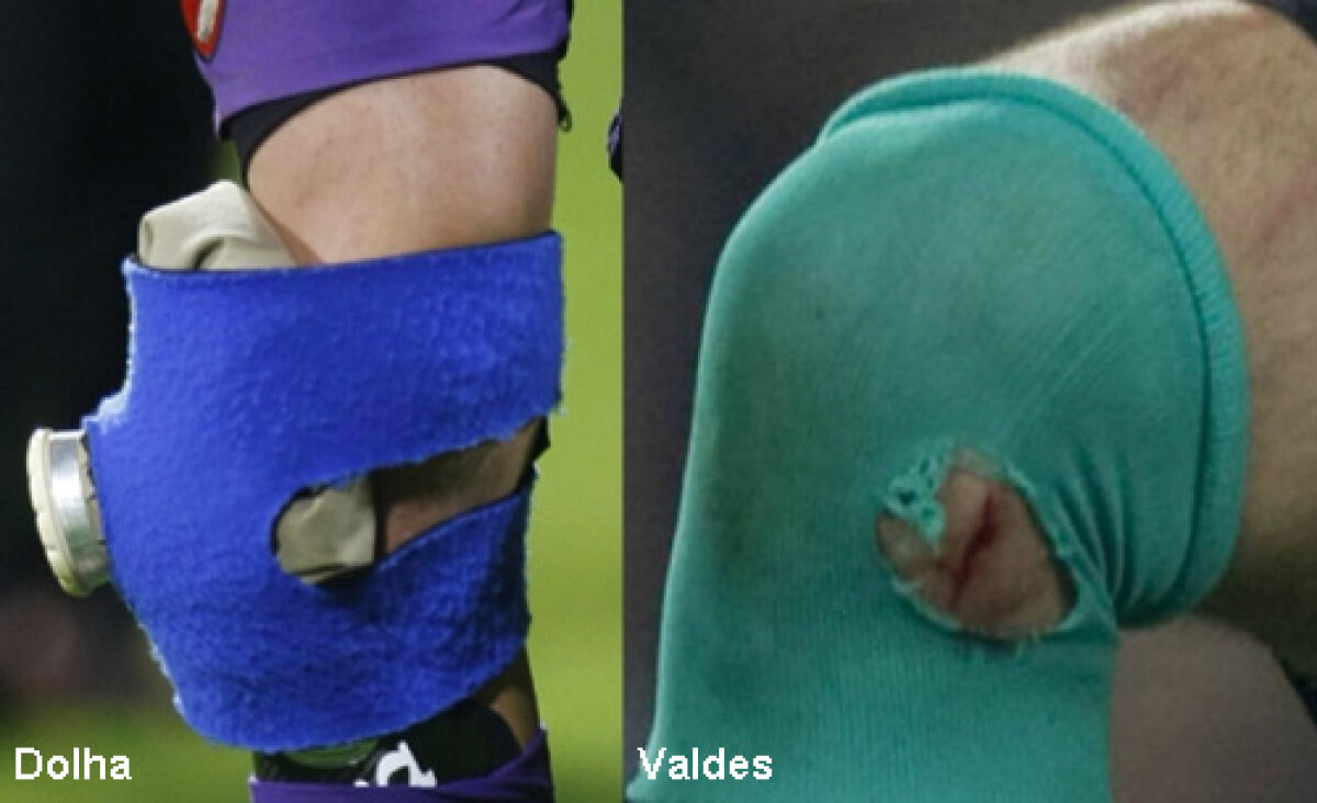 Ce au în comun Valdes şi Dolha » "Operaţie" fără anestezie