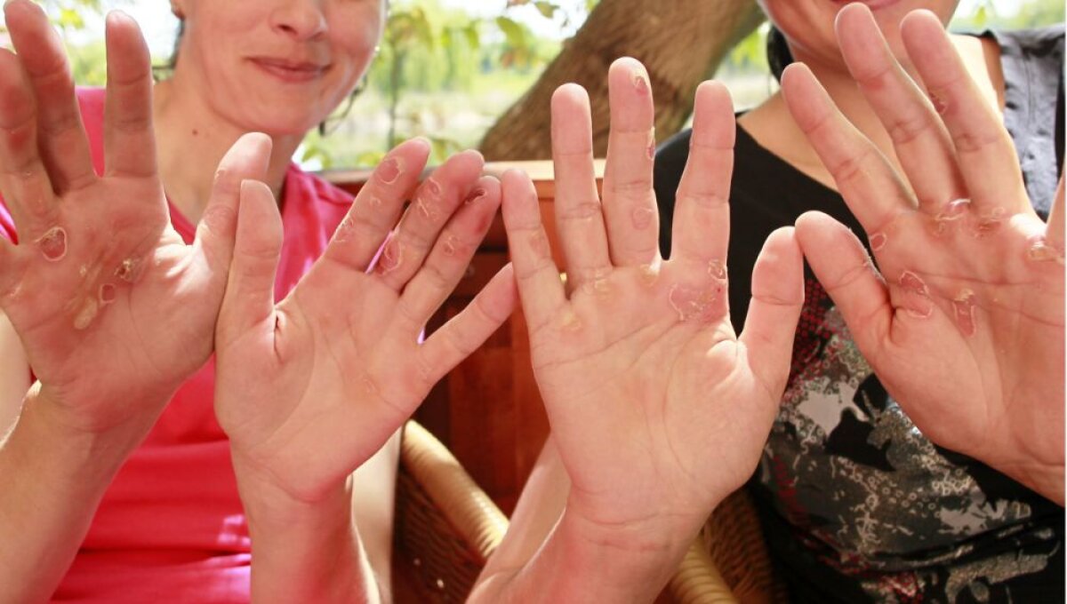 Campioanele olimpice revin în barcă » Întoarcerea la chinuri