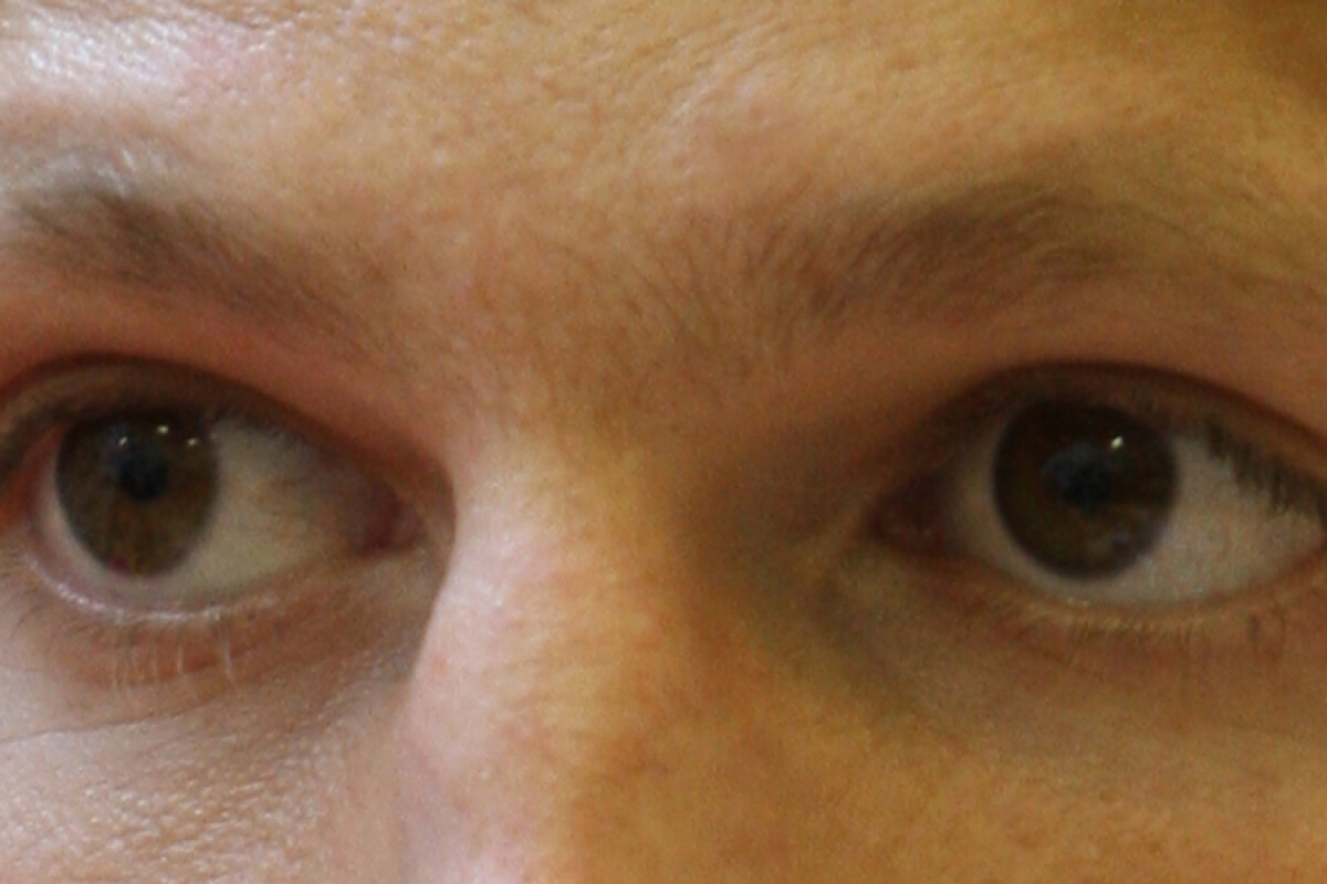 Mihai Neşu nu respiră singur şi îşi comunică gîndurile clipind în faţa unui alfabet mînuit de soţie » Cum se scrie ”durere” cu ochii