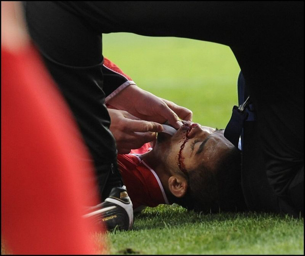 Încă o accidentare teribilă, în Belgia » Cu faţa zdrobită