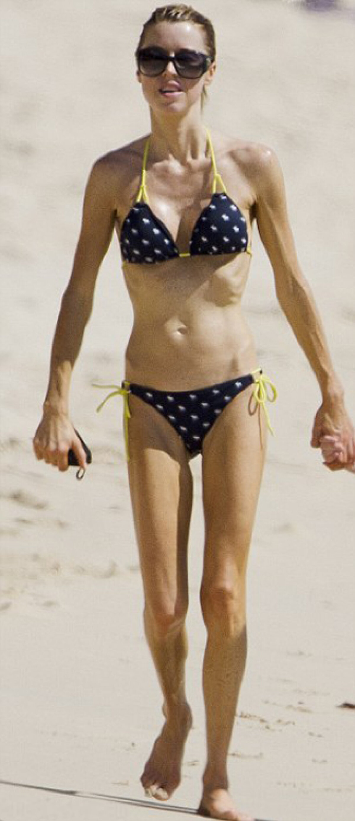 GALERIE FOTO Soţia lui Phil Neville, prea slabă!