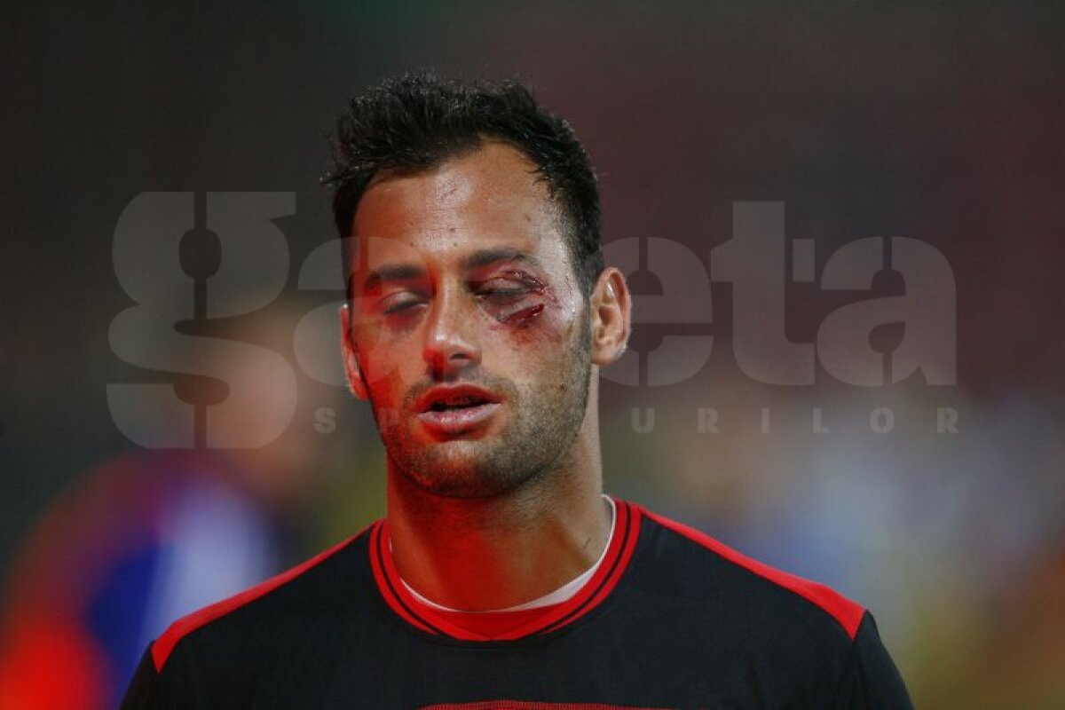 VIDEO şi FOTO Fotbal sau război? » 36 de copci pentru Beto!