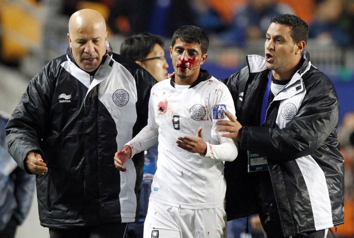 VIDEO Se poate întîmpla şi la alţii! Bătaie generală la meciul dintre Suwon şi Al Sadd