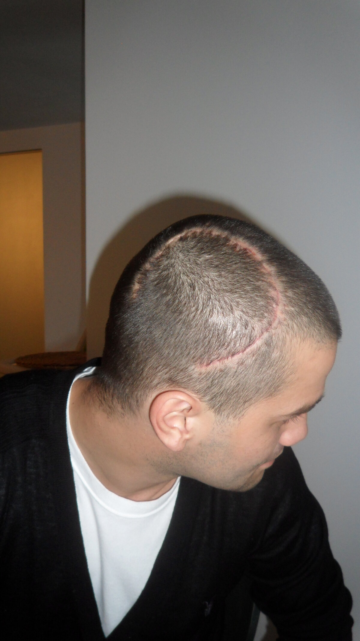 Varianta Stelei. Galamaz a fost la un pas de tragedie