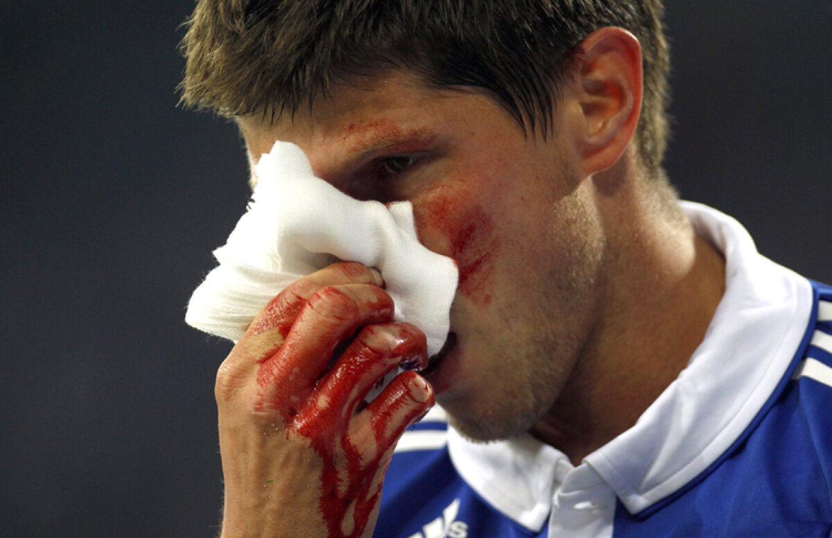 GALERIE FOTO Huntelaar a fost dus de pe teren direct la spital şi operat timp de o oră