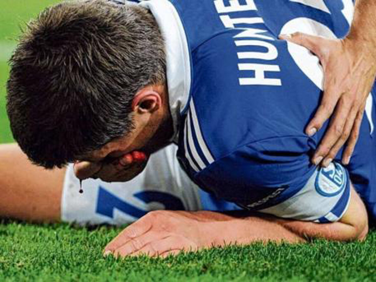 GALERIE FOTO Huntelaar a fost dus de pe teren direct la spital şi operat timp de o oră