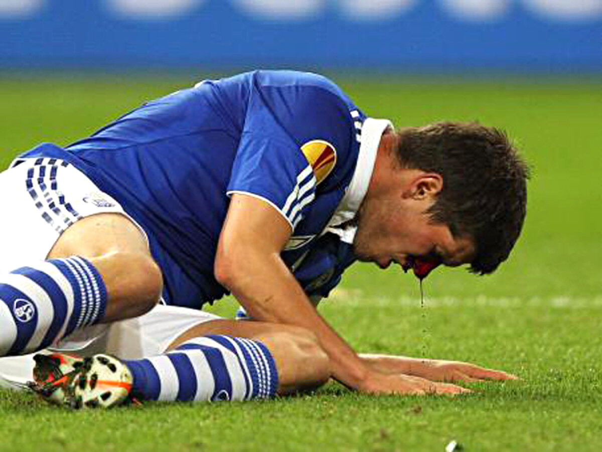 GALERIE FOTO Huntelaar a fost dus de pe teren direct la spital şi operat timp de o oră