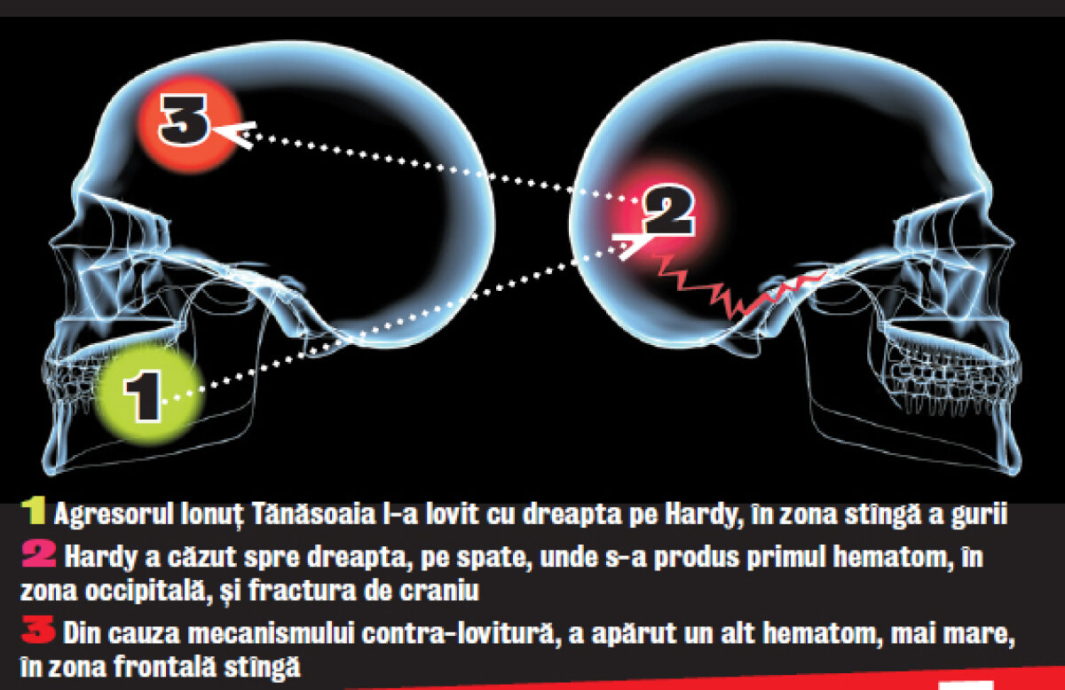 Avea creierul rupt » Autopsia a relevat că decesul lui Hardy s-a produs în urma unor multiple leziuni cranio-cerebrale