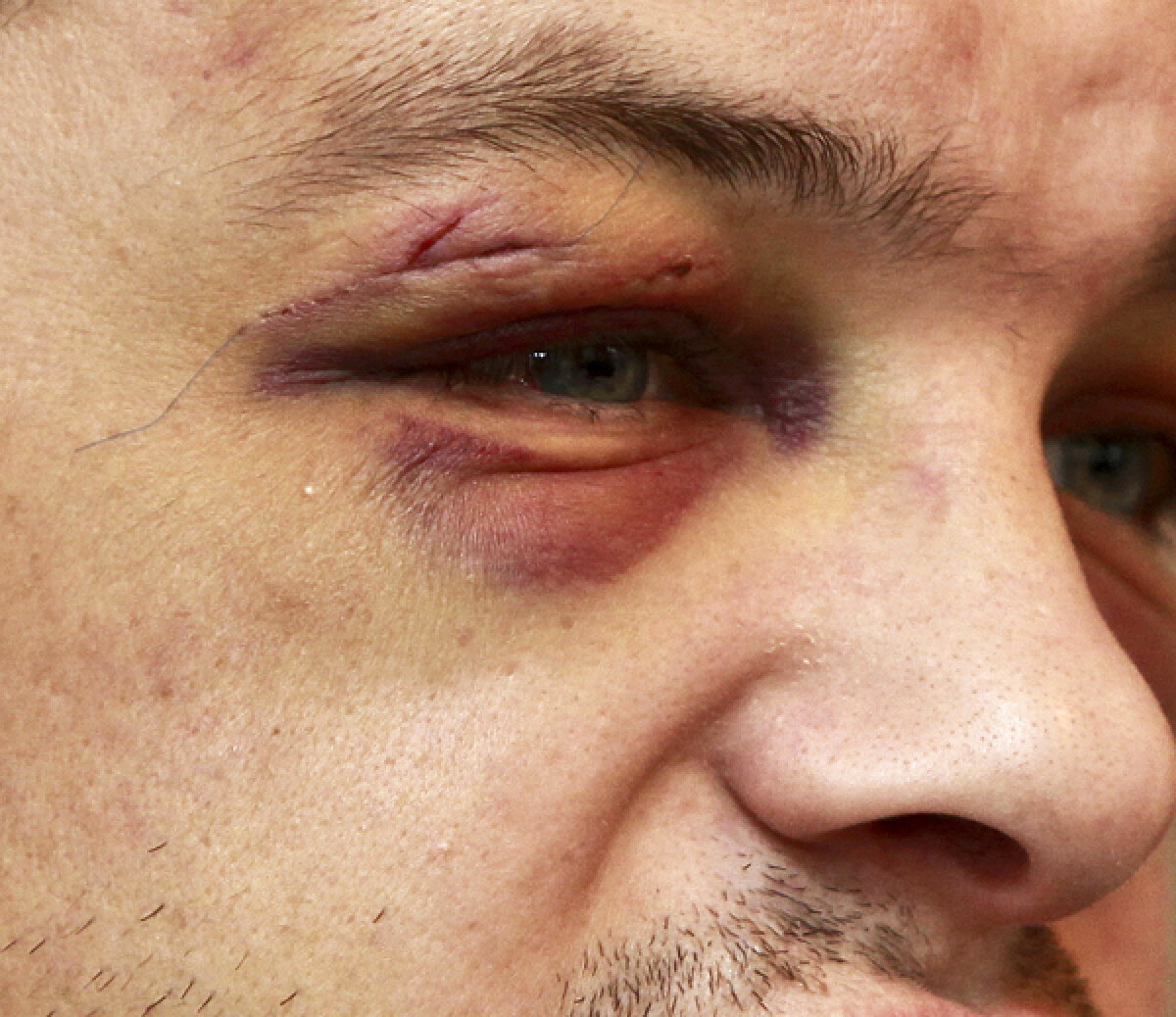 Gazeta l-a vizitat pe JoJo Dan, aflat în convalescenţă, la Trabzon » Soartă de boxer