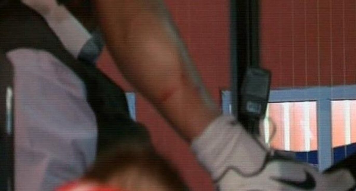 FOTO » Dănciulescu şi-a arătat rănile provocate de adversar