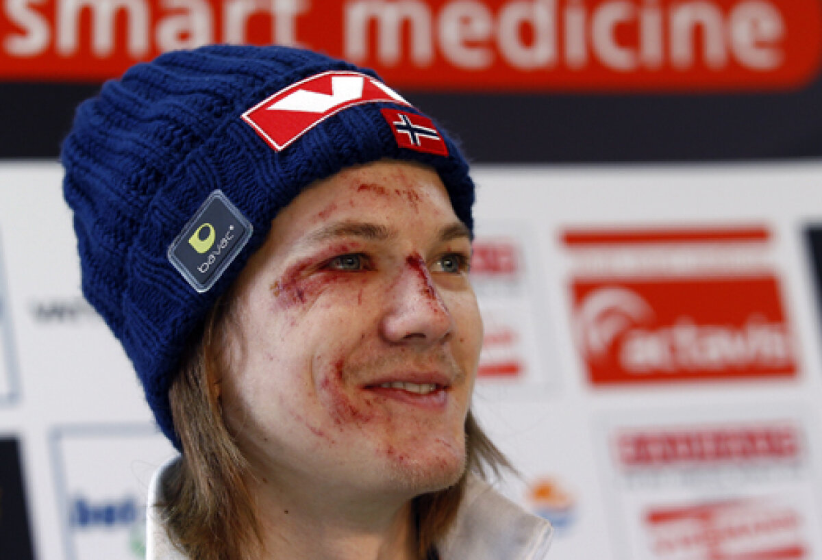 Cele mai importante imagini ale weekend-ului » Soare şi durere