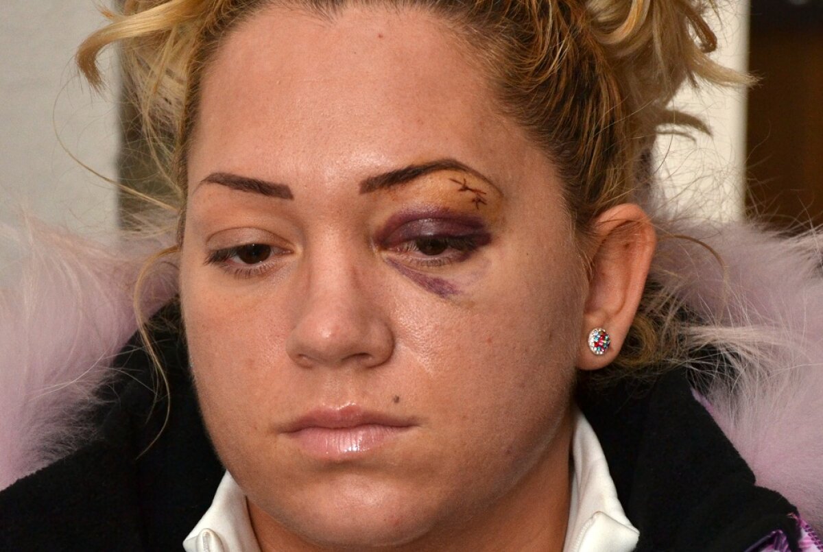 FOTO Scandal în baschetul feminin » Două baschetbaliste de la CS Tîrgovişte sînt acuzate că au bătut o tînără într-un club