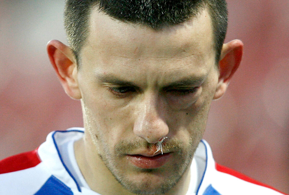 FOTO Imagini horror în Gruia » Sălăgeanu s-a ales cu fractură de pomete