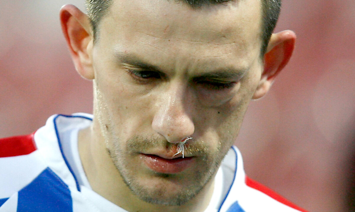 FOTO Imagini horror în Gruia » Sălăgeanu s-a ales cu fractură de pomete