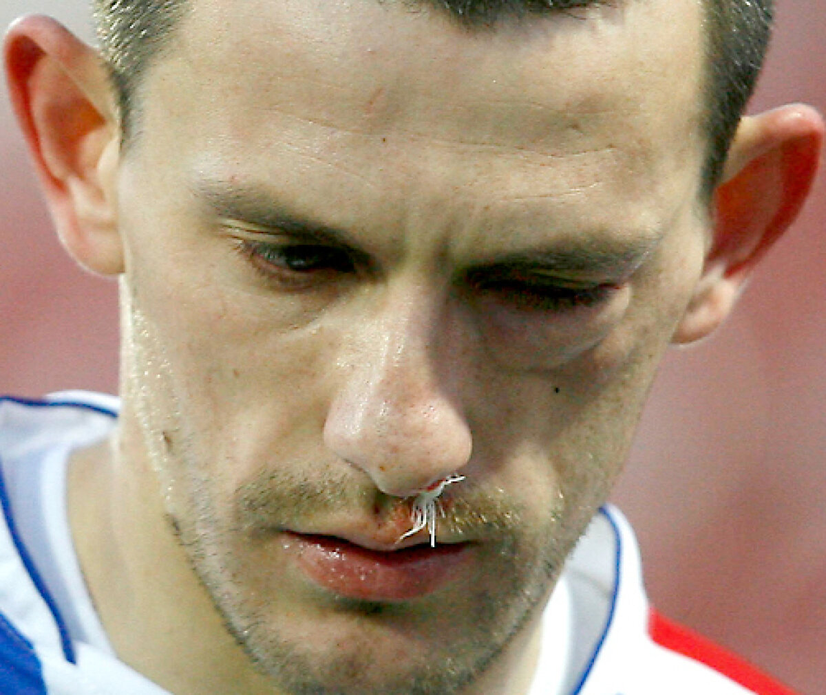 FOTO Imagini horror în Gruia » Sălăgeanu s-a ales cu fractură de pomete