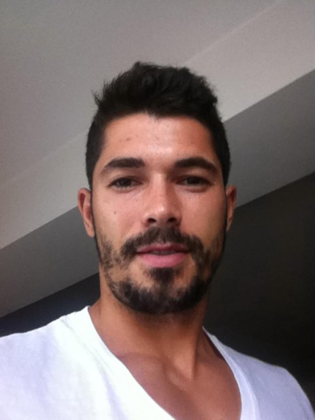 FOTO Herea a scăpat de varicelă, dar a rămas cu semne :D