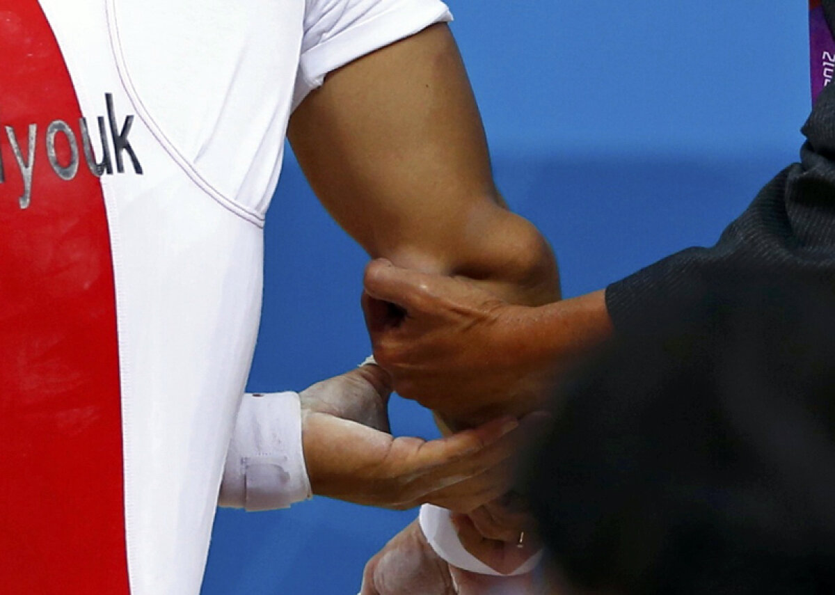 FOTO Horror! » Imagini terifiante cu cotul dislocat al sud-coreeanului Sa