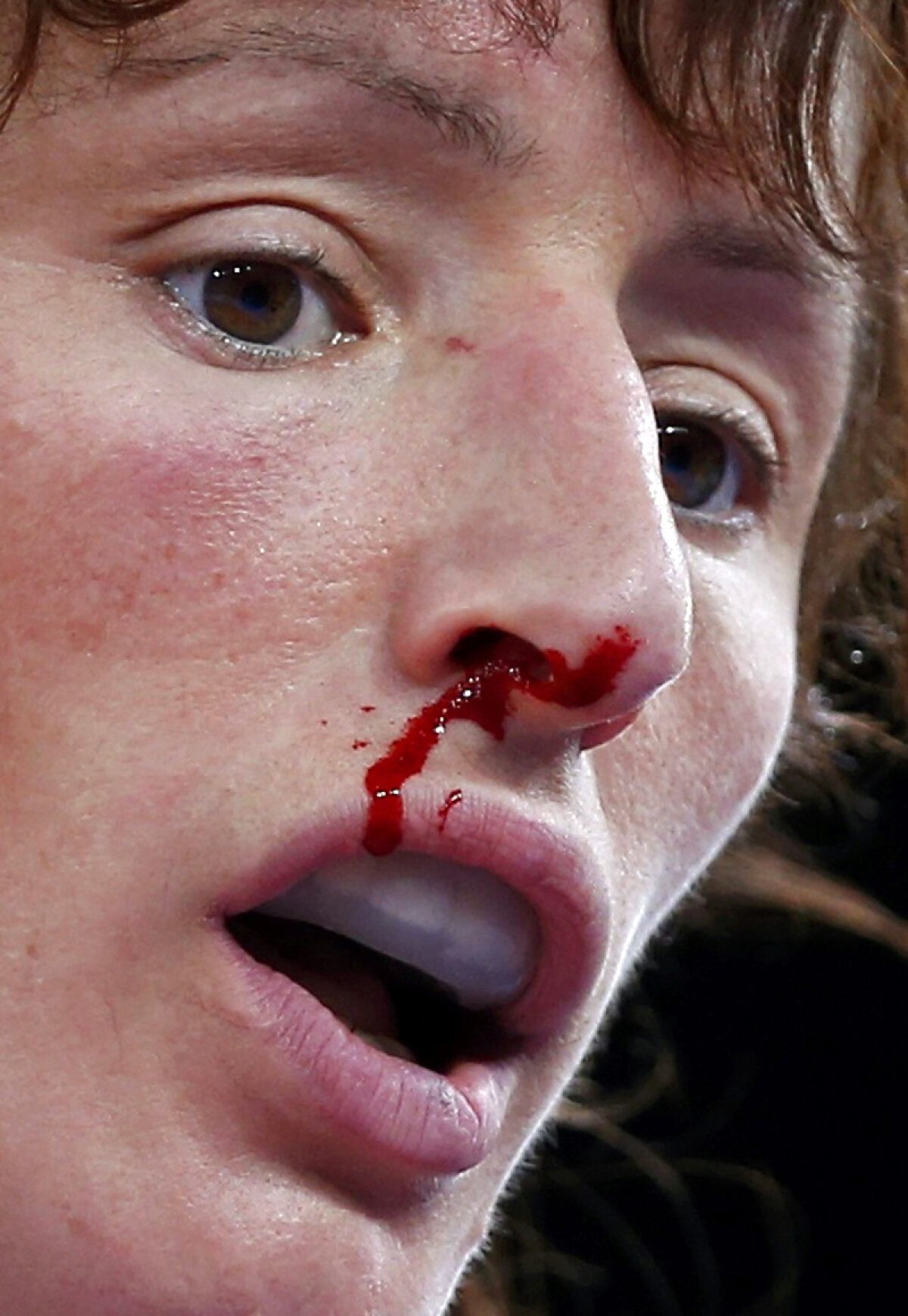 GALERIE FOTO True Blood » Cele mai sîngeroase imagini de la Jocurile Olimpice